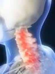 Neck Pain - Complete Chiropractic - Allentown Pa 18106